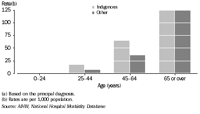 Graph: Male rates of hospitalisation for diseases of the circulatory system(a), by Indigenous status—2003–04