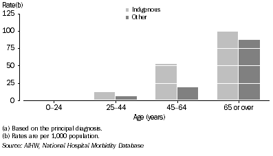 Graph: Female rates of hospitalisation for diseases of the circulatory system(a), by Indigenous status—2003–04